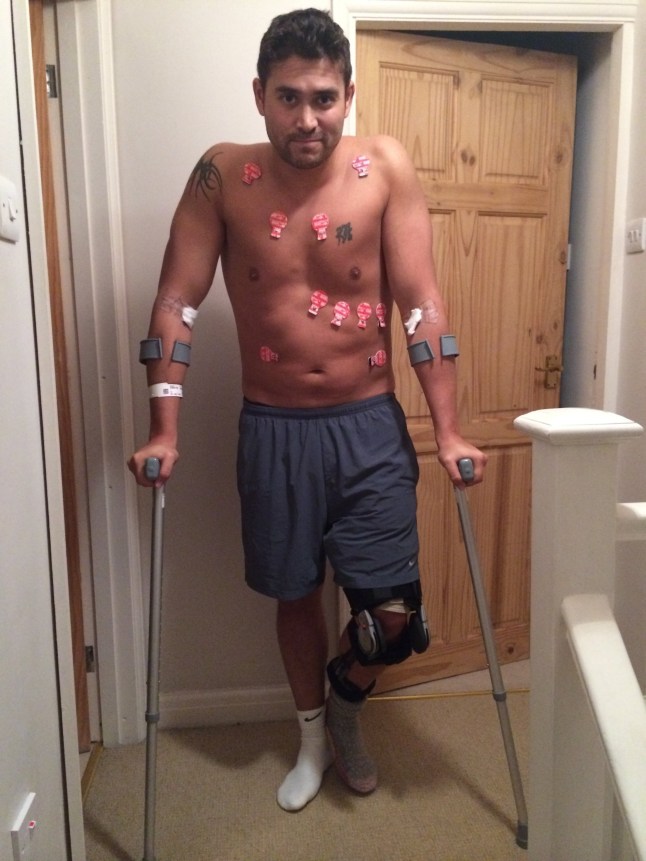 Irwin Mitchell of ex Crimewatch presenter Rav Wilding who is suing the production company behind Splash!, saying an injury he suffered while training for the diving show has derailed his career. PRESS ASSOCIATION Photo. Issue date: Wednesday August 31, 2016. The ex-Strictly contestant said he had to cancel his wedding and has now put his home on the market because of the accident, which occurred in pre-show training in 2013. Wilding, 38, underwent surgery after snapping the hamstring tendons in his left leg during a somersault dive on the third session of training for the now defunct ITV show. See PA story SHOWBIZ Wilding. Photo credit should read: Irwin Mitchell /PA Wire NOTE TO EDITORS: This handout photo may only be used in for editorial reporting purposes for the contemporaneous illustration of events, things or the people in the image or facts mentioned in the caption. Reuse of the picture may require further permission from the copyright holder. EMBARGOED TO 0001 WEDNESDAY AUGUST 31 Undated handout photo issued by